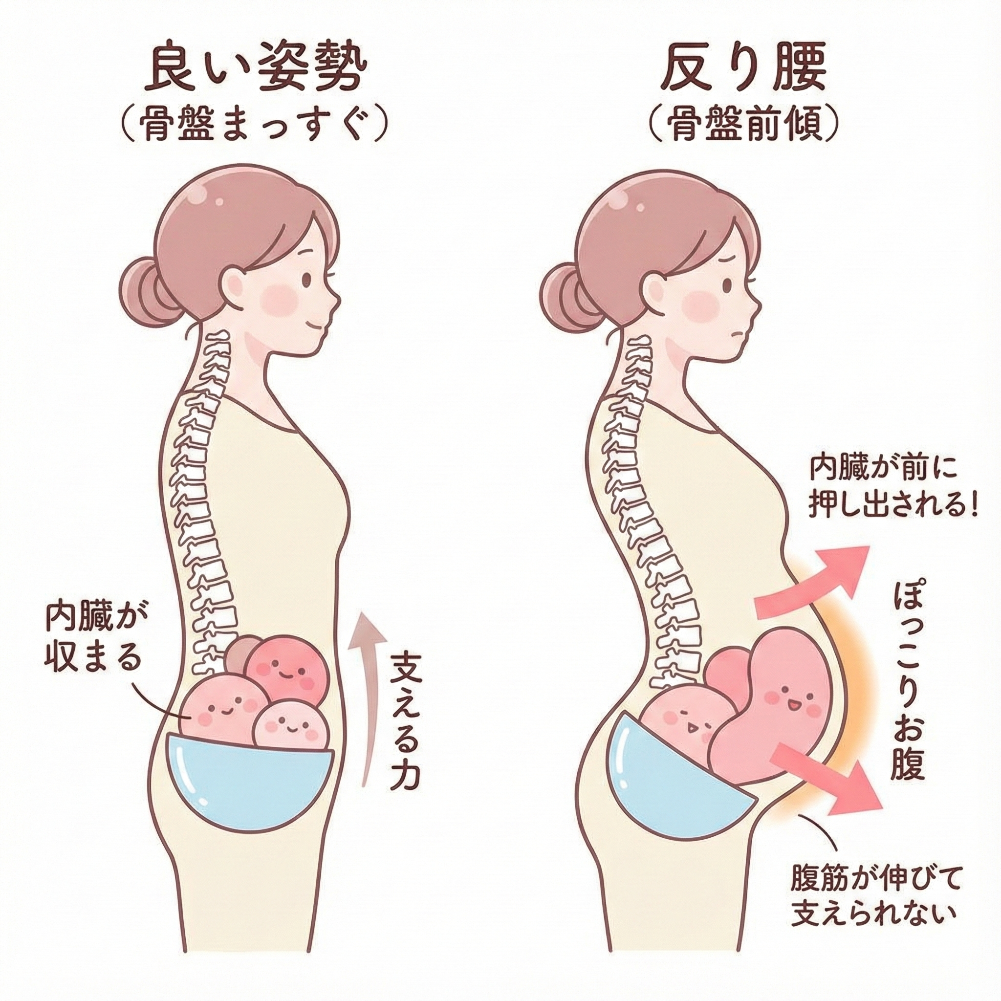 反り腰によって内臓が前に押し出される図解