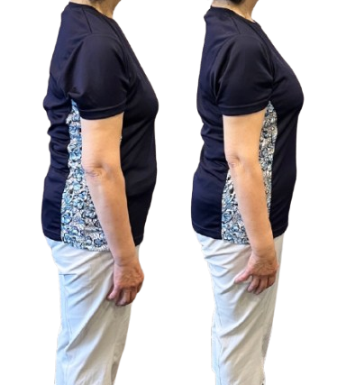 ARISANFIT会員様のビフォーアフター(姿勢改善と引き締め)